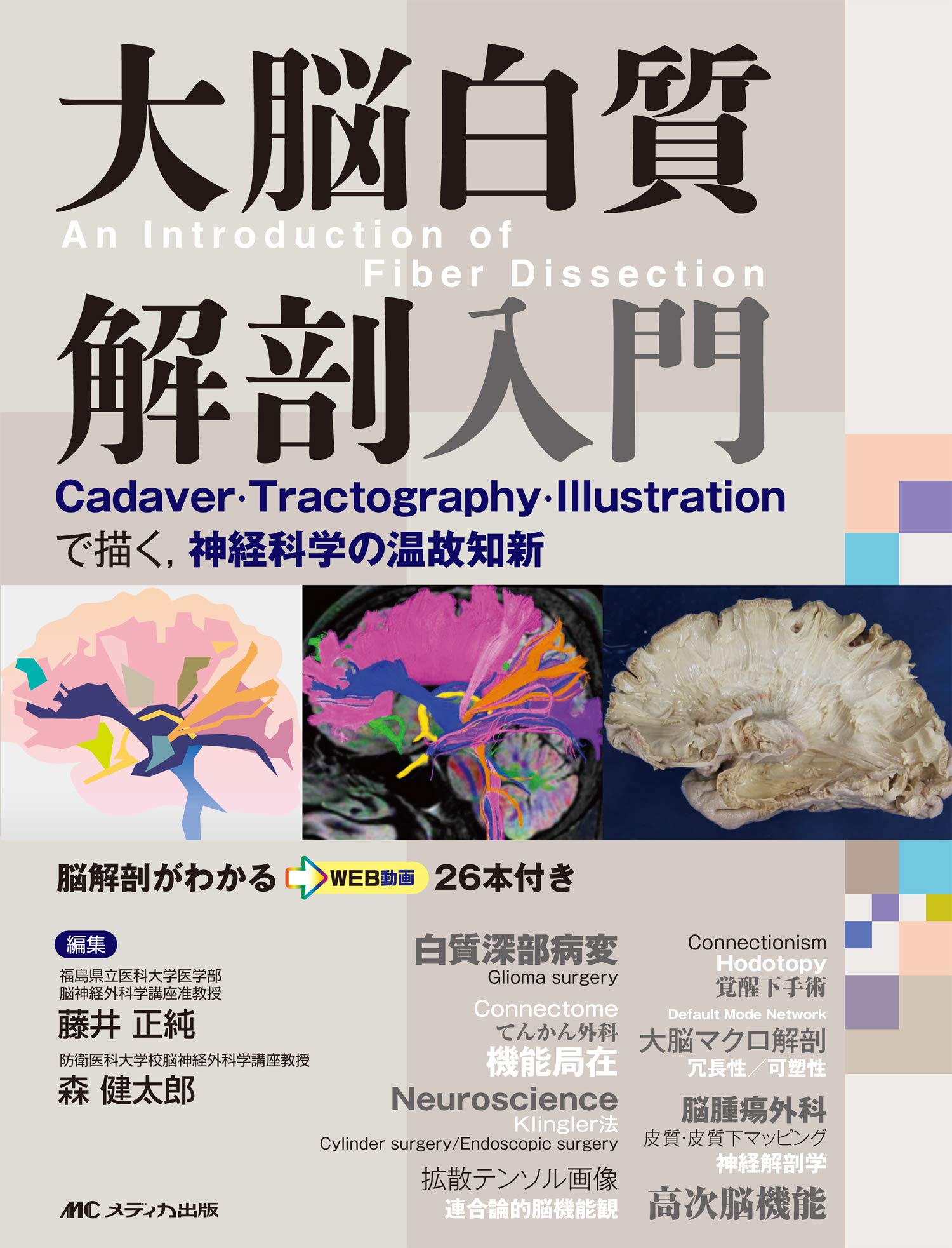 大脳白質解剖入門(An Introduction of Fiber Dissection): Cadaver