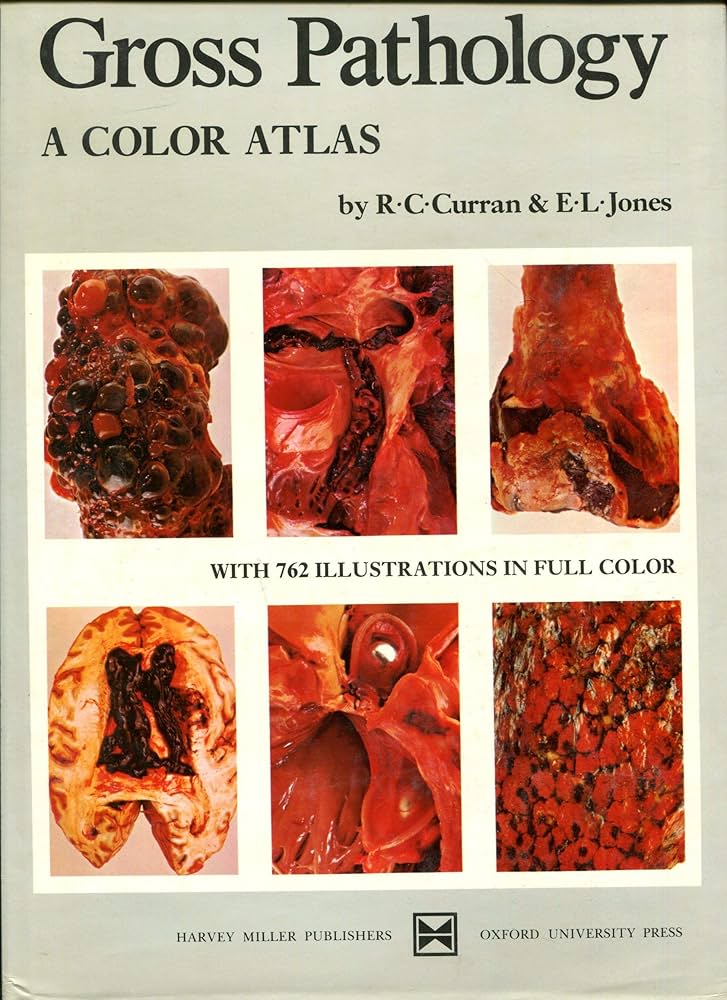 Amazon.com: Gross Pathology: A Color Atlas: 9780195197976: Curran