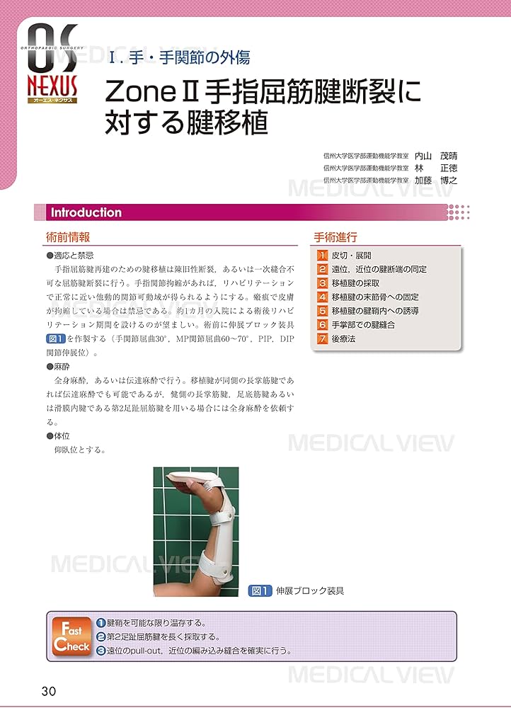 Amazon.com: 手・手関節の骨折・外傷の手術 (OS NEXUS(電子版付き) 3