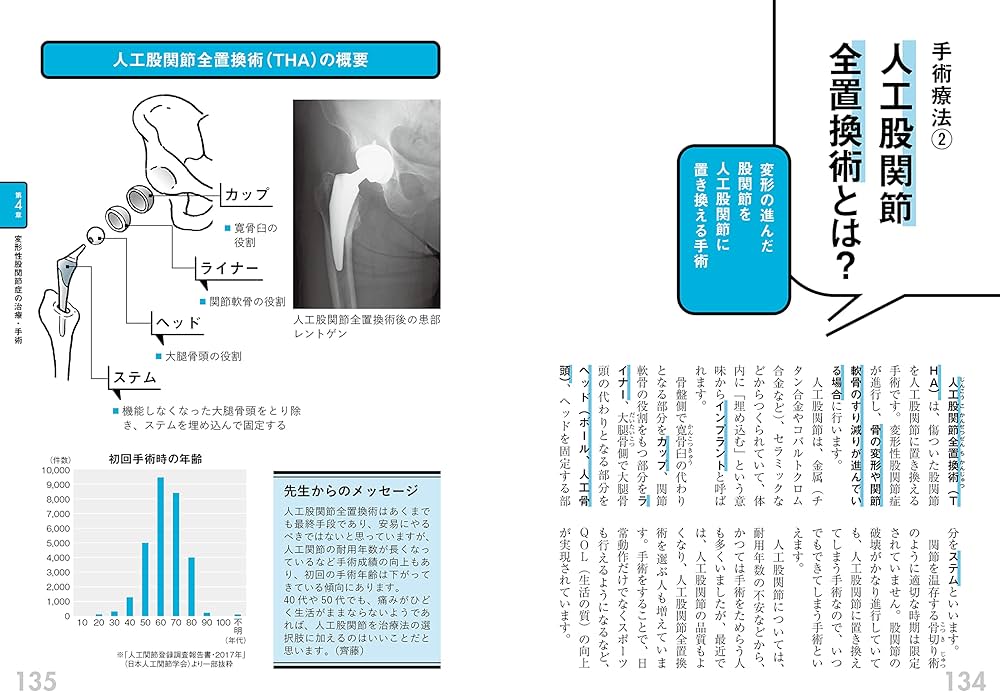 股関節痛の教科書 自分に合ったケアと治療法がわかる | 齊藤 貴志