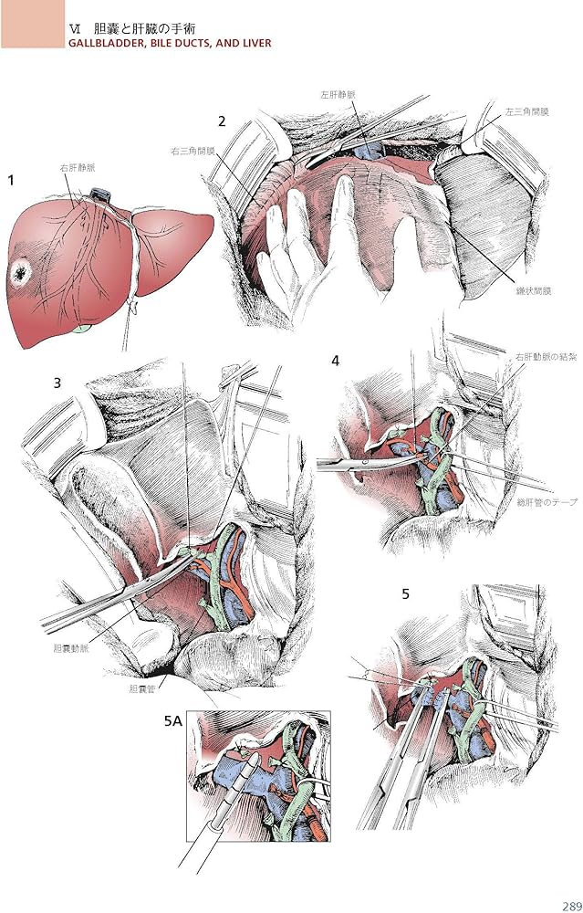 Amazon.co.jp: ゾリンジャー外科手術アトラス 第2版 : 安達 洋祐