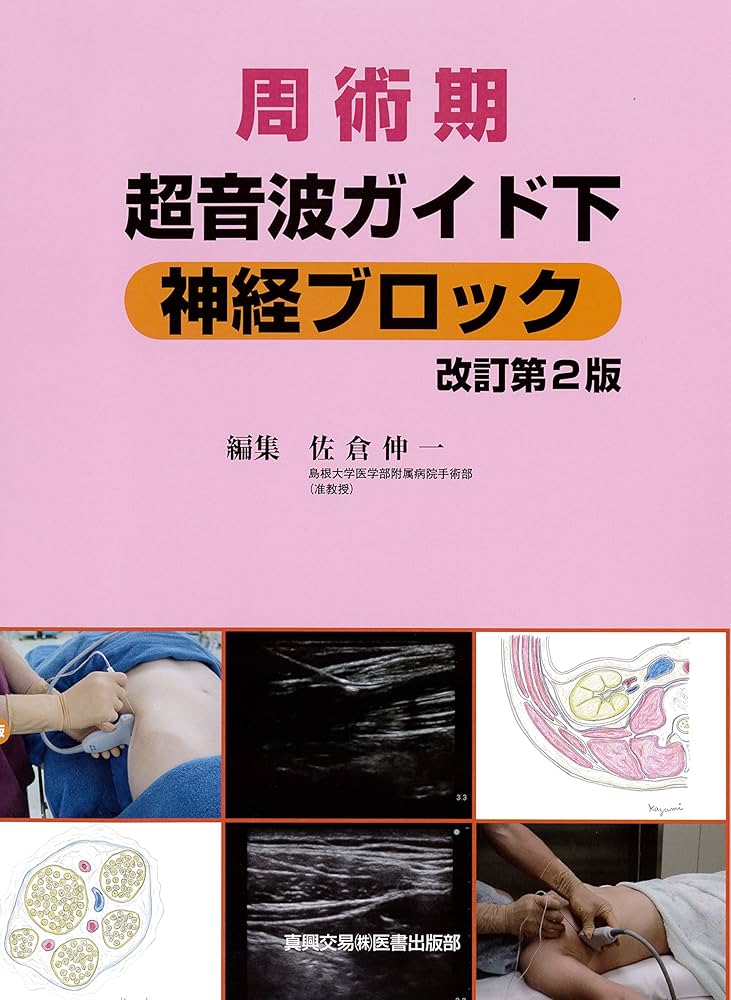 Amazon.co.jp: 周術期超音波ガイド下神経ブロック : 佐倉 伸一: 本