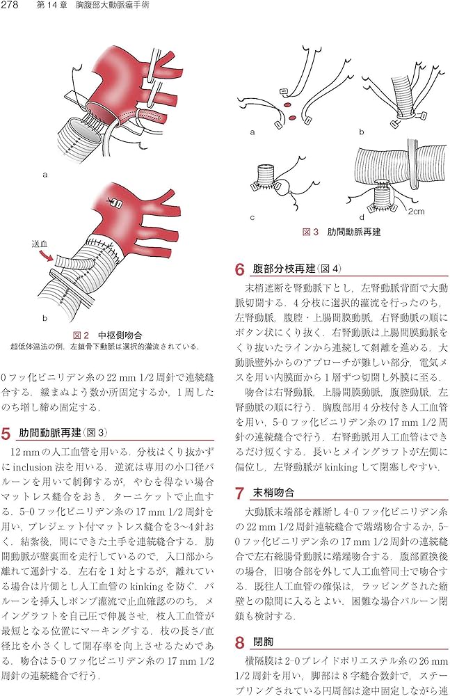 心臓・大動脈外科手術: 基本・コツ・勘所 | 小坂 眞一 |本 | 通販 | Amazon