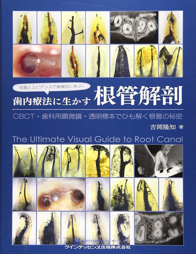 写真とエビデンスで歯種別に学ぶ! 歯内療法に生かす根管解剖 | 吉岡 隆