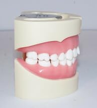 Amazon.co.jp: 歯科 模型 ニッシン 顎模型 根管治療 エンド NISSIN