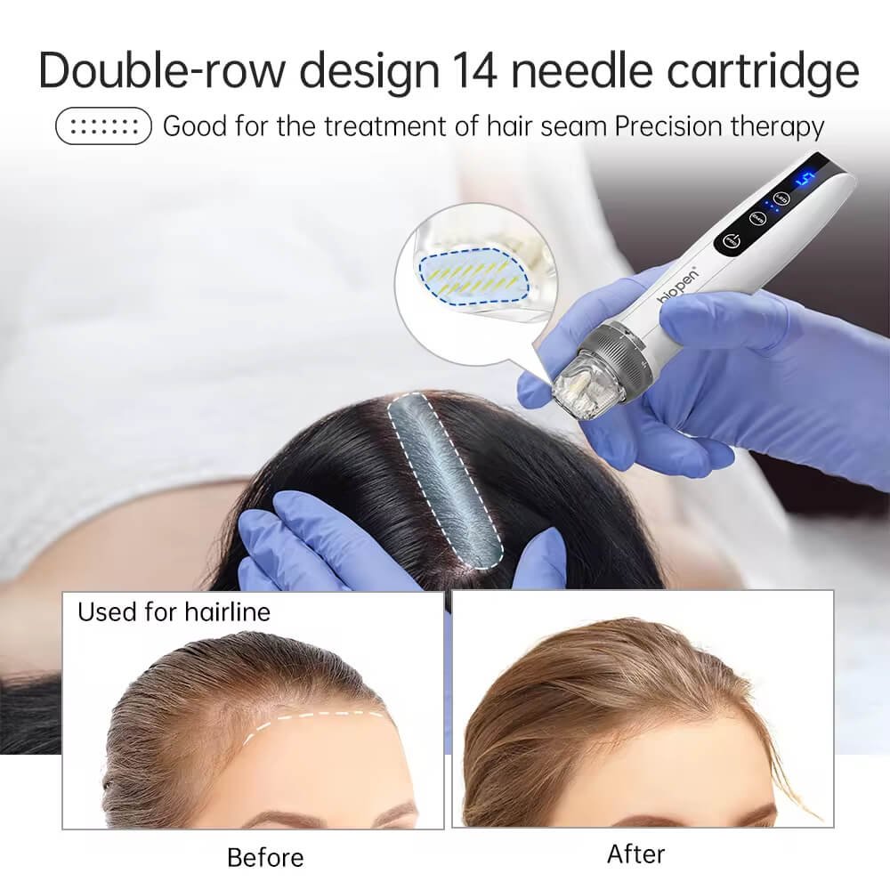 バイオペンQ2：皮膚の若返りのための高度なマイクロニードルデバイス