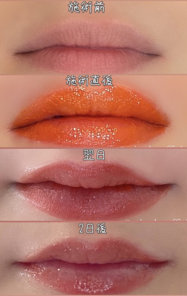 リップアートメイクやってきました！体験レポ 1回目と2回目ダウン