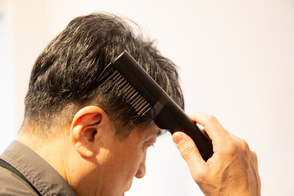 ヤーマンの最新兵器」自宅でサロン級はもう常識!? 生え際にも攻め込む