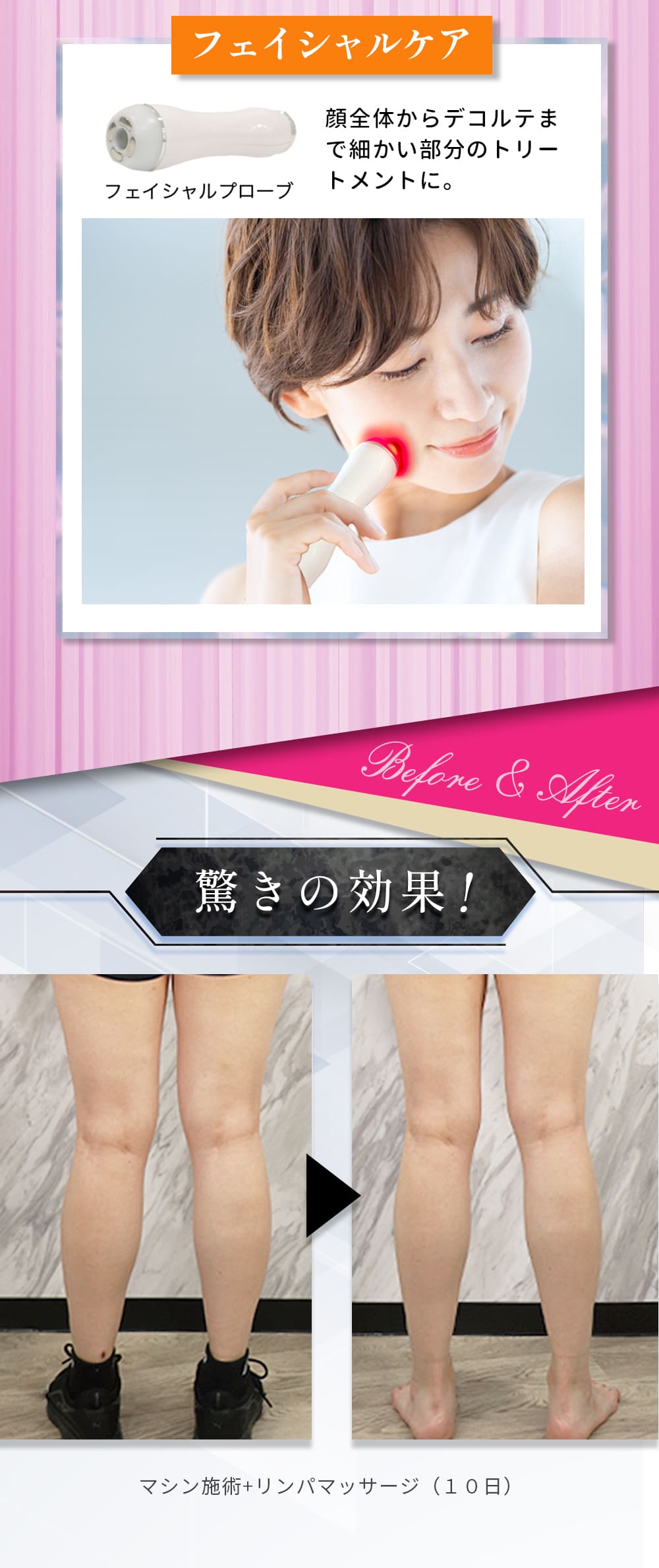 RADI CRASH ラジクラッシュ 株式会社モイセ 日本製の業務用美容機器