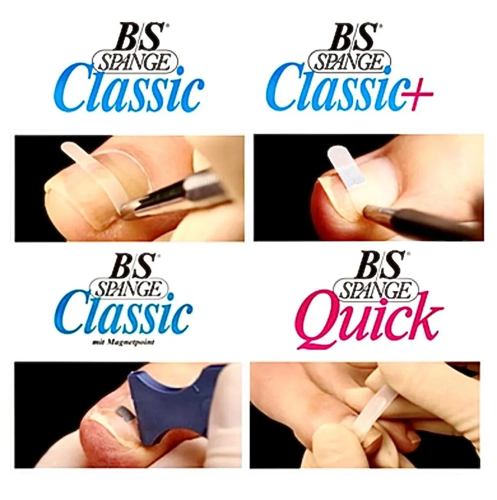 多摩エリアの巻き爪矯正なら「ななスキンケア皮膚科クリニック」｜B/S