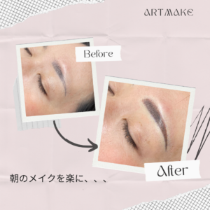 アートメイク｜近鉄生駒駅【奈良】の形成外科・美容皮膚科｜なかにし