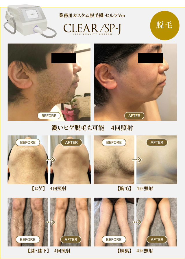 セルフ脱毛・セルフエステ開業は【NBS公式】