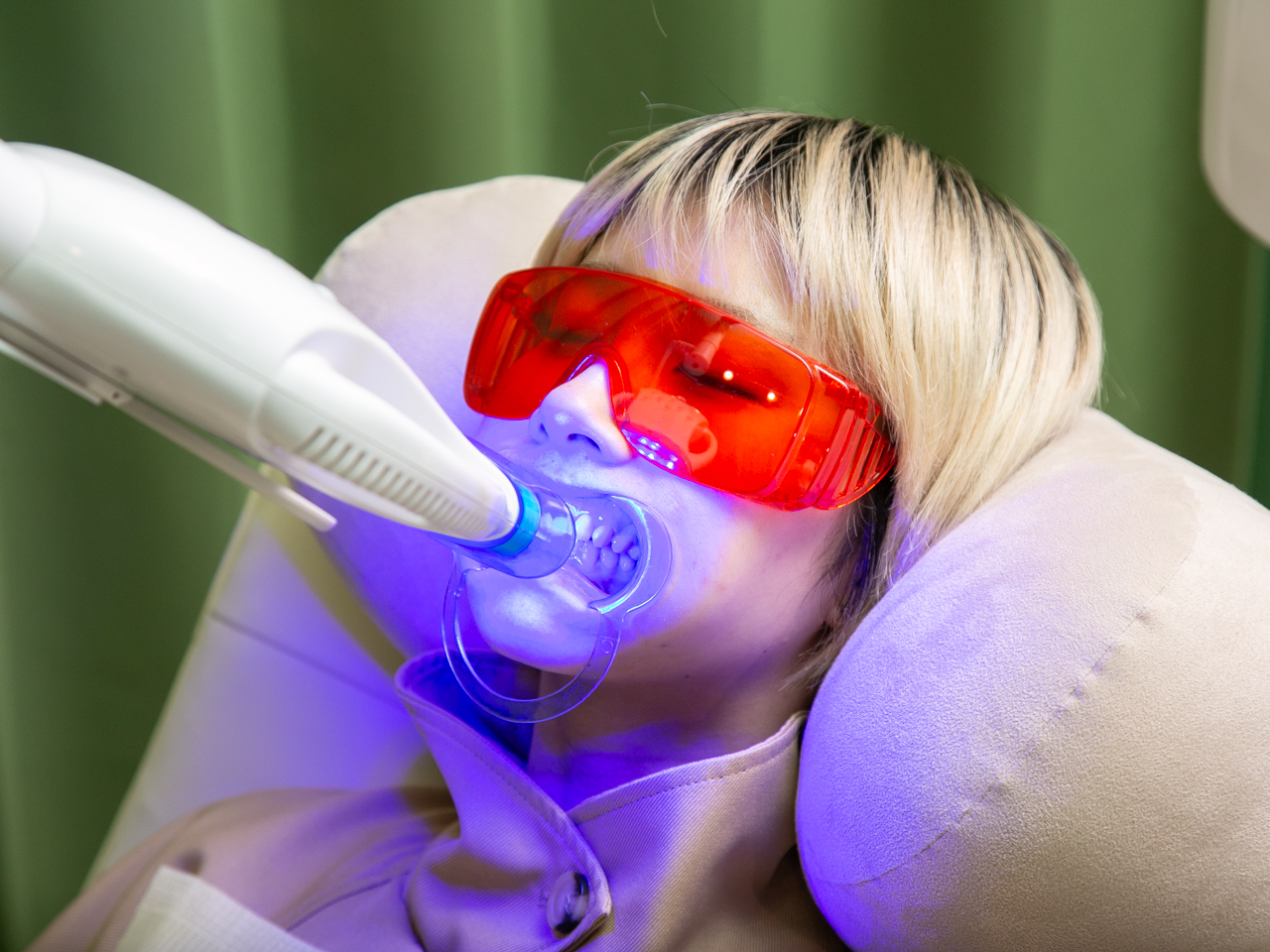 歯ホワイトニング30分】すぐに白くそして持続♪口臭まで消える☆4,400