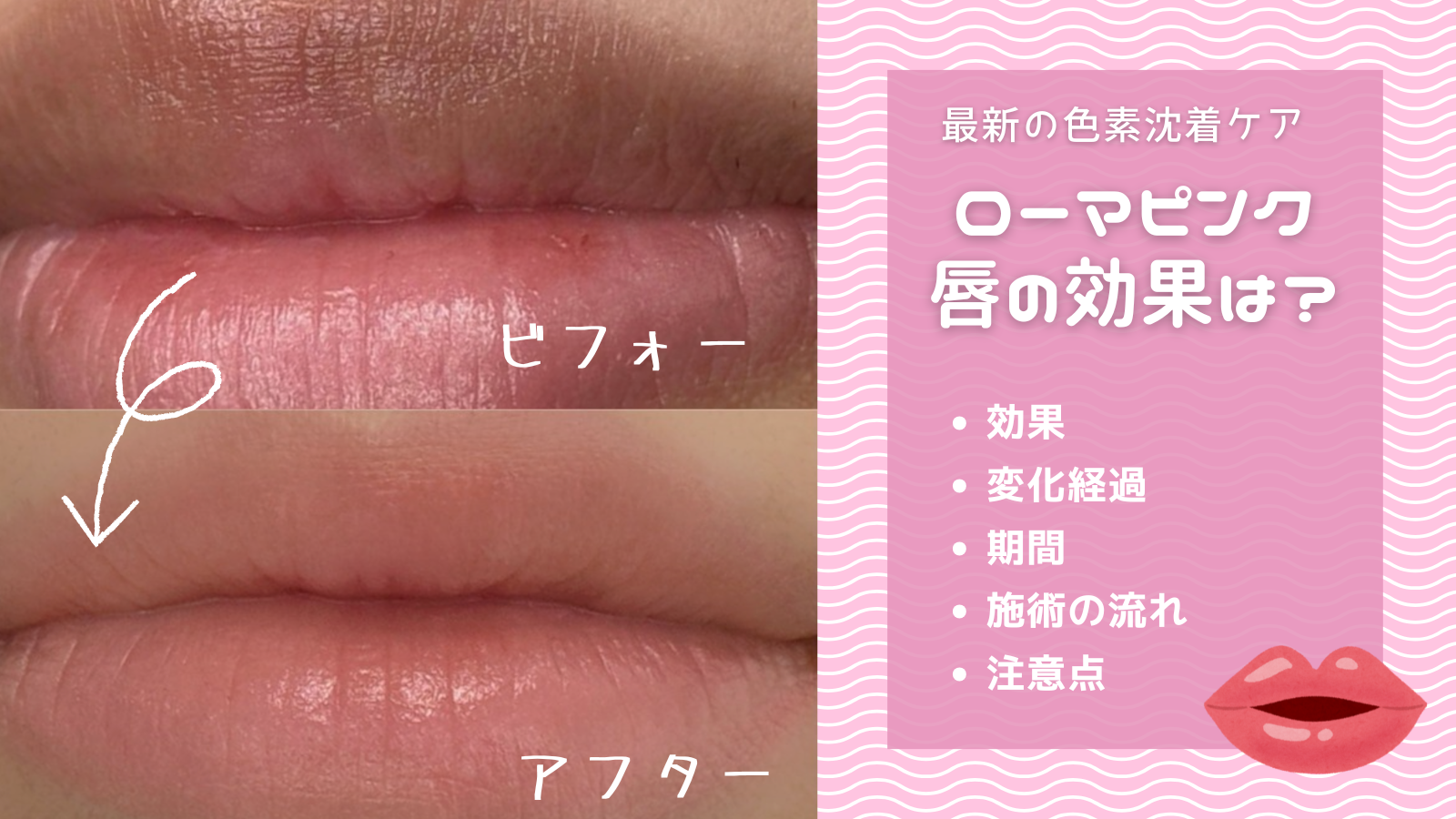 Roma Pink アフタークリームリップ用 ローマピンク リップ用アフター