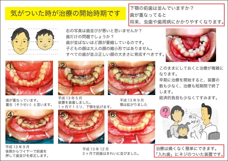 床矯正ポスター｜書籍・冊子・説明ツール｜オーラルアカデミー