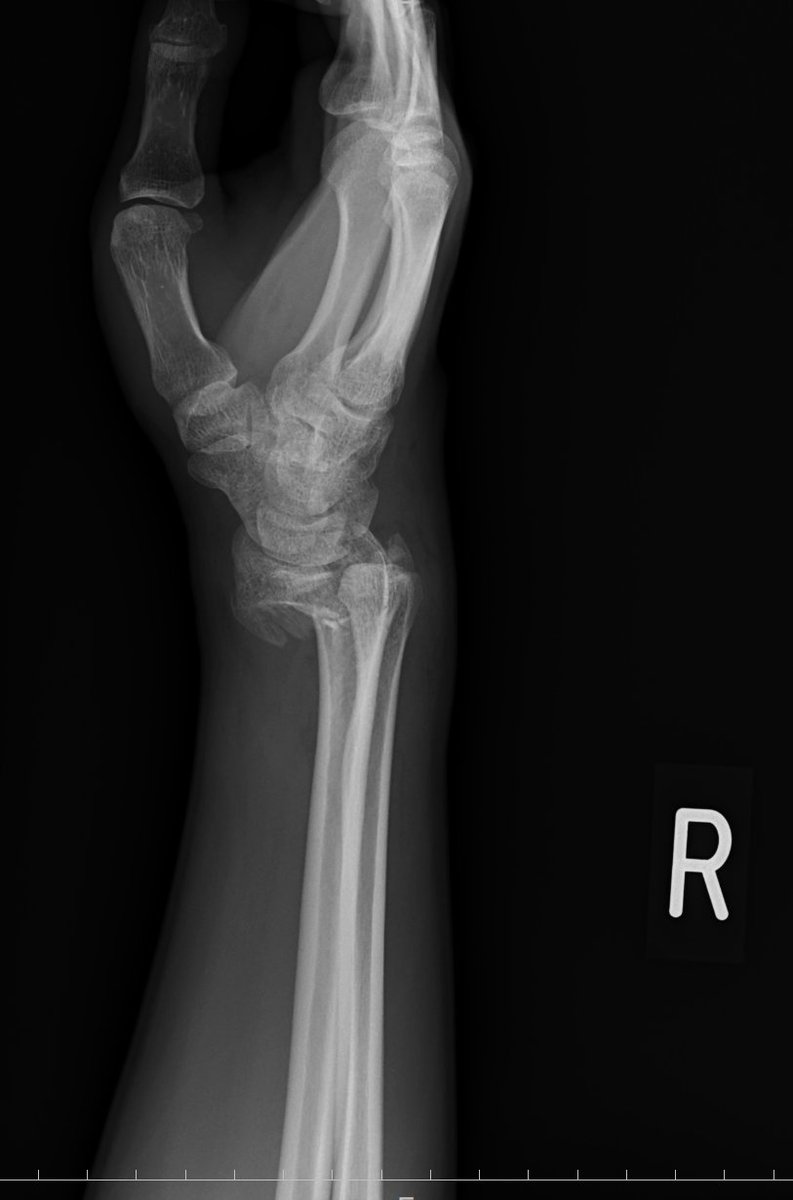 わさびちゃん (@wsbbbb) / Posts / X