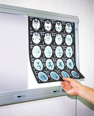 シャウカステン【Schaukasten(独)】〔医〕X線写真（レントゲン写真