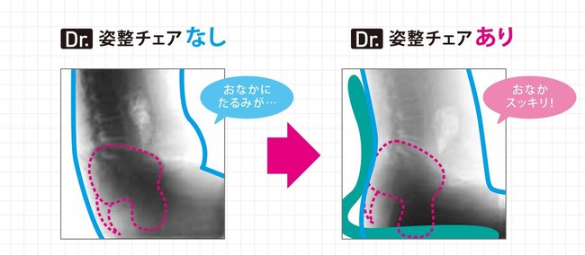 座るだけ、正しい姿勢に導く「Rupose Dr.姿整チェア」直近売上前年比