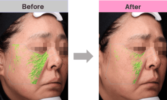 éclat BEAUTEⅡ | RE L'ABEAUTE（リアボーテ）