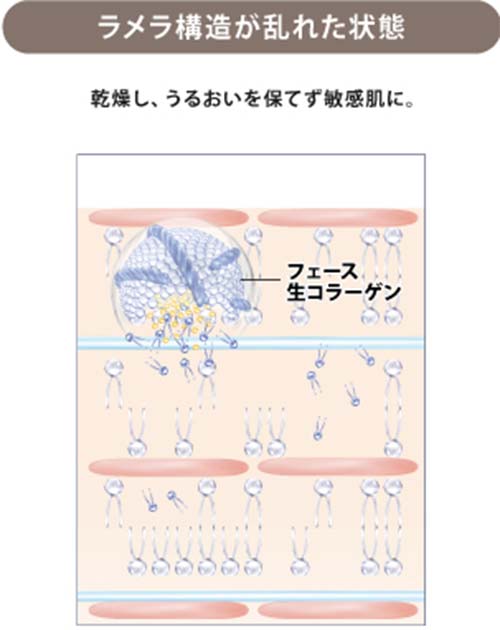 ラメラボ モイスチャージェル エンリッチ通販|麗ビューティー