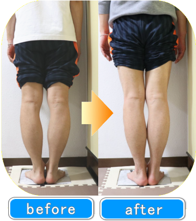 美品 奥秋大輔先生 選ばれ続けるO脚矯正プログラム DVD 2枚セット