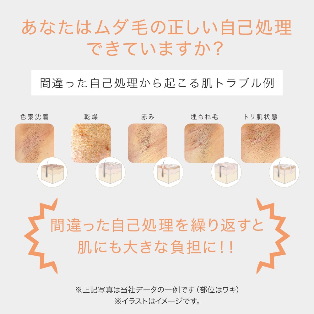 ヒカリビューティ 4 PRO: 美容機器｜TBCオンラインショップ