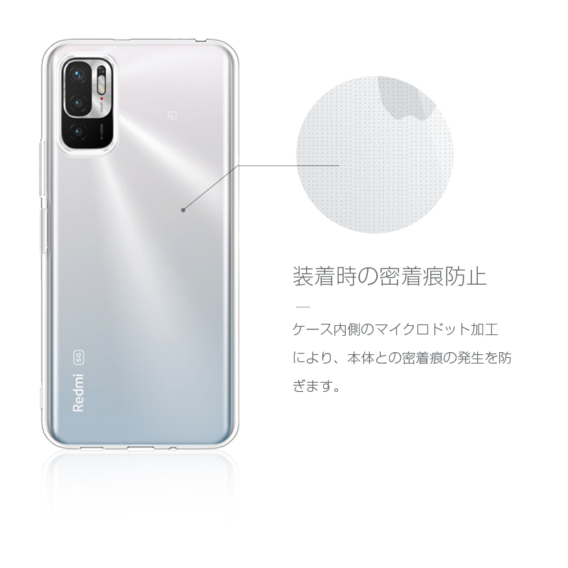 明誠 Redmi Note 10 JE XIG02 / Redmi Note 10T スマホケース TPU
