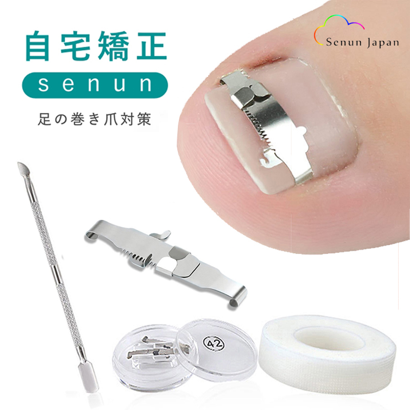 巻き爪 矯正 セット サポート 器具（ケース付き） ネイルケア ツール
