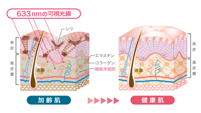 BEAUCOLLA HYBRID（ビューコラハイブリッド） | 酸素カプセル