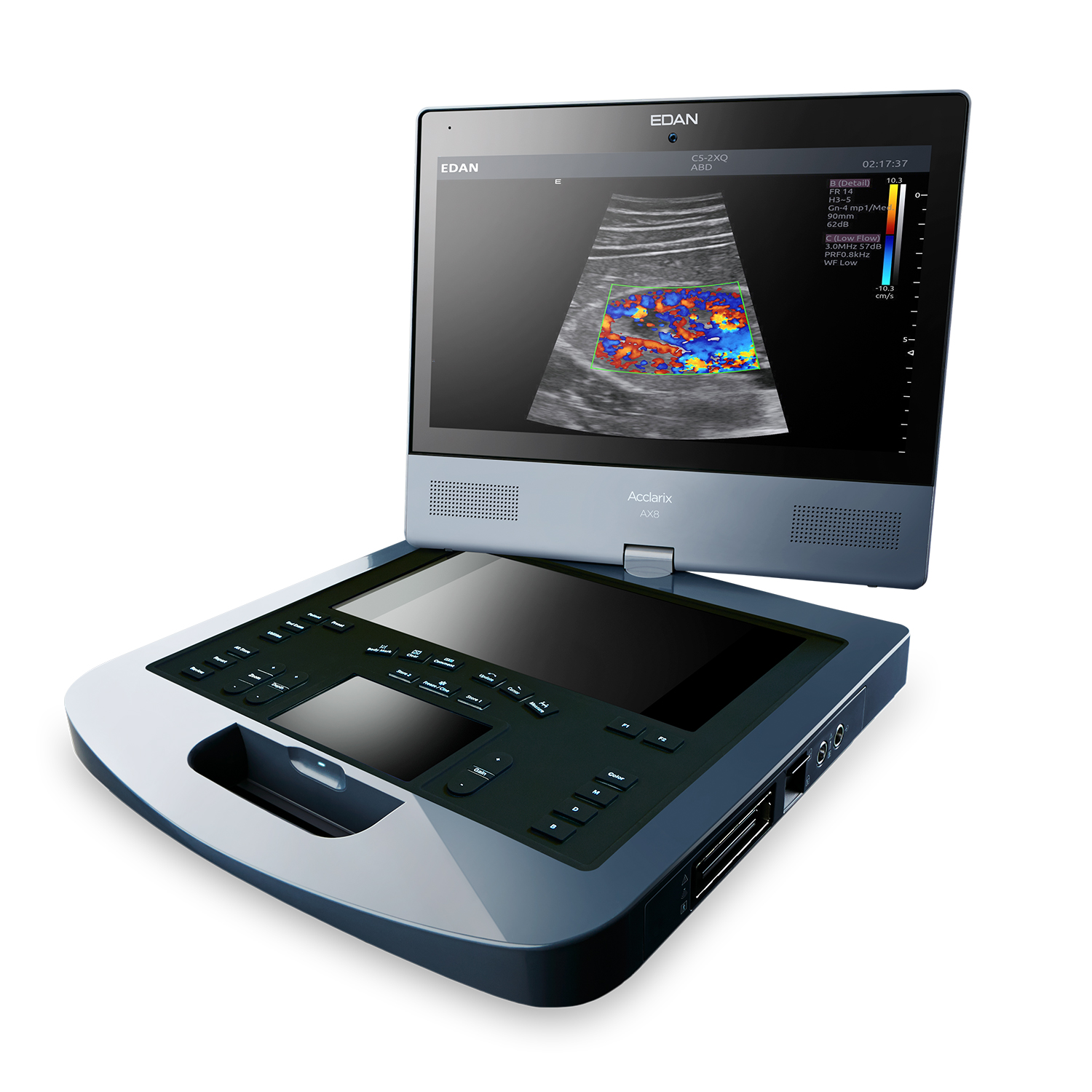 Edan Acclarix AX8 Portable Ultrasound - With Laptop Mobility