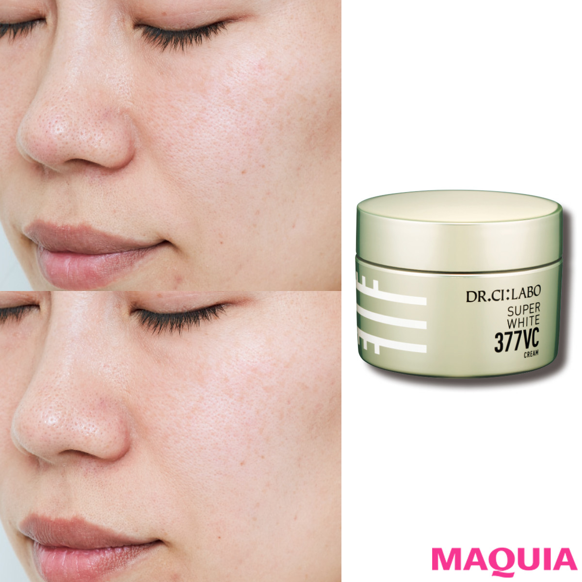 ビタミンCはすごかった！ ドクターシーラボの美白クリームを30日間試し