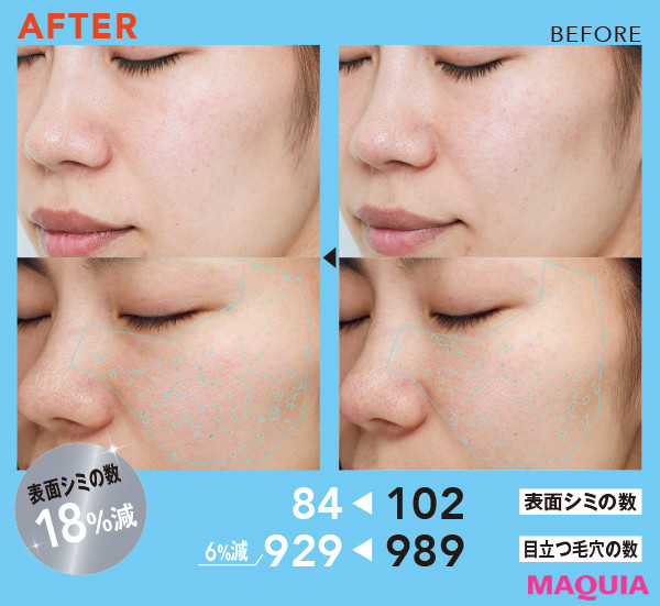 ビタミンCはすごかった！ ドクターシーラボの美白クリームを30日間試し