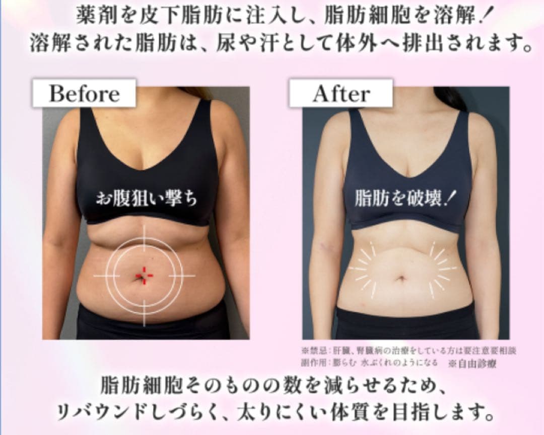 即ヤセ!! 激痩せ!!皮下脂肪溶解 カベリン!!残り1セットのみ☆5ボトルセット 💉🔥カベリン8mL 脂肪溶解注射🫧 | お知らせ | Credo Clinic