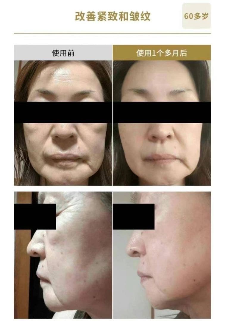 新品ナリスセルグレースフォーミュラI・II セット*3最高峰エイジング